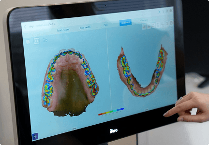 iTero 3D scan of a patient's teeth on screen at Regent Dental